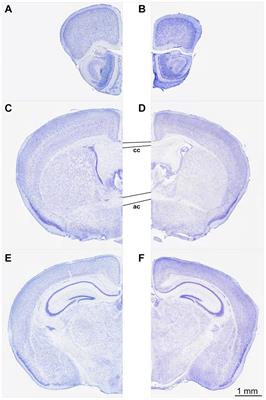 Differently increased volumes of multiple brain areas in Npc1 mutant mice following various drug treatments